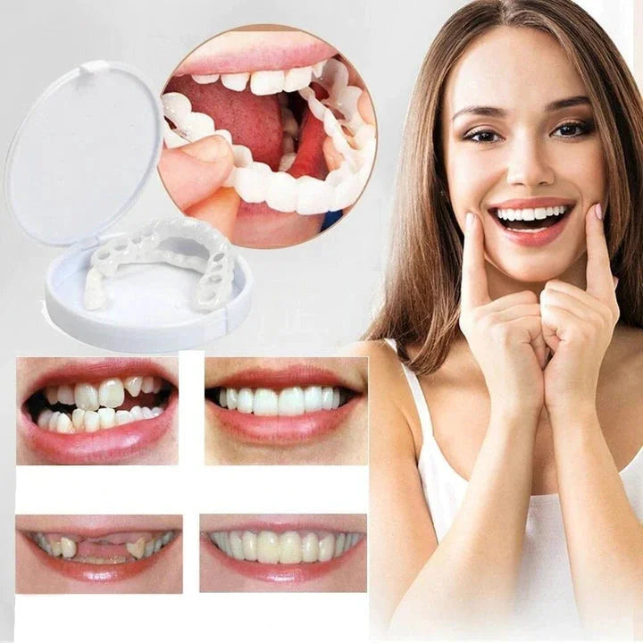 Snap-On Smile fazety pro kompletní horní a dolní zuby