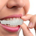 Set di faccette dentali per sorriso superiore e inferiore