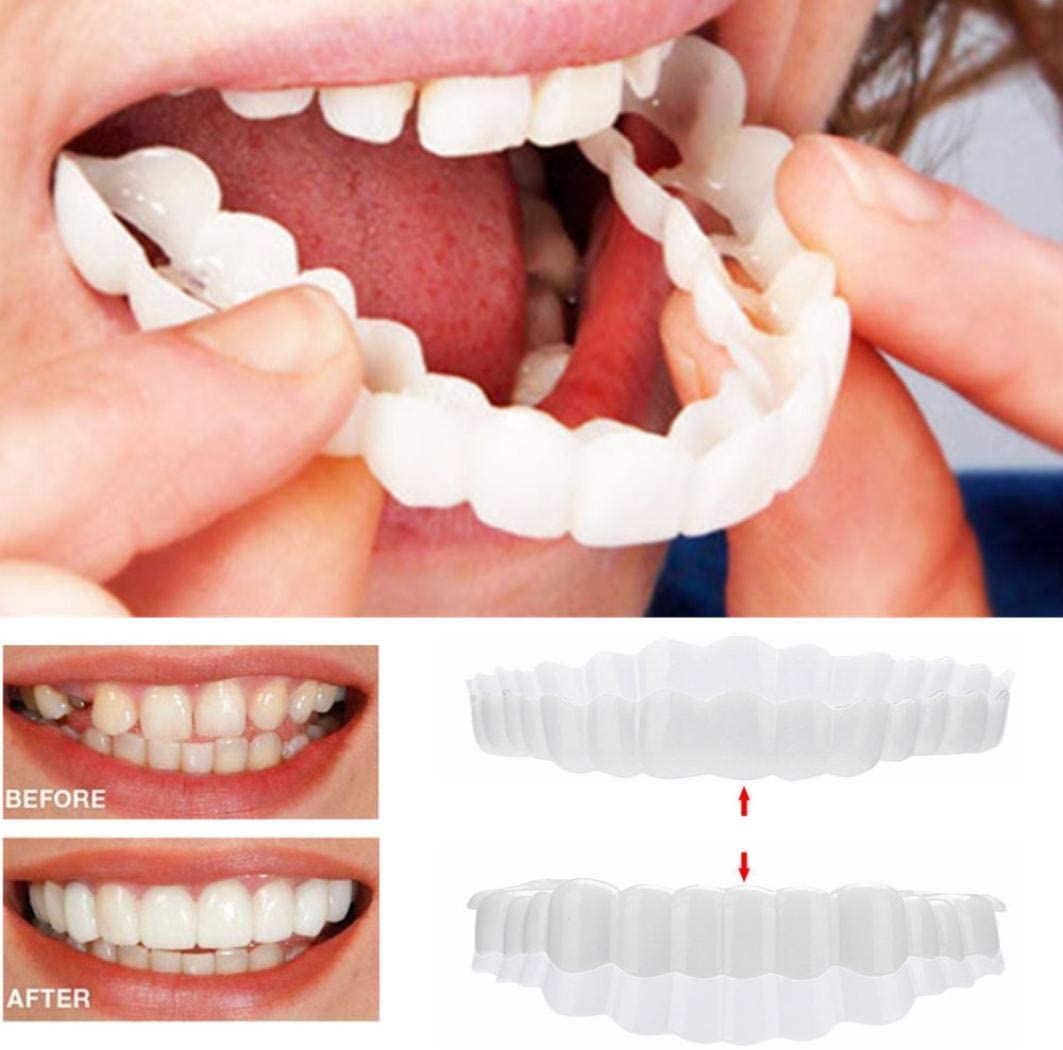Set di faccette dentali per sorriso superiore e inferiore