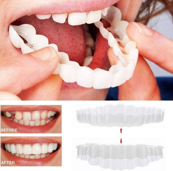 BrightSmile Veneers Set With Upper And Lower Jaw Included | Fervei
