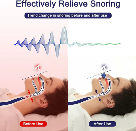 AeroLite Micro CPAP přístroj na spánkovou apnoi pro cestování a proti chrápání