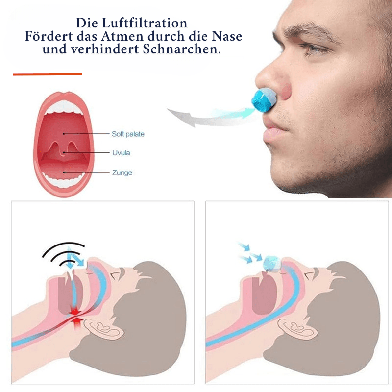 BreezeGuard Anti-Snoring Air Filter System For Better Sleep And Healthy Breathing
