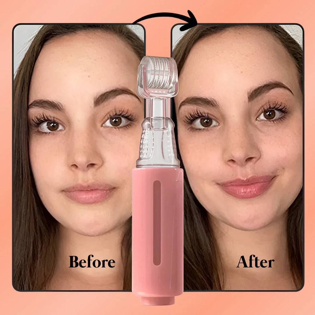 Lip Booster Kit Gentle Natural Lip Plumper For Fuller Lips