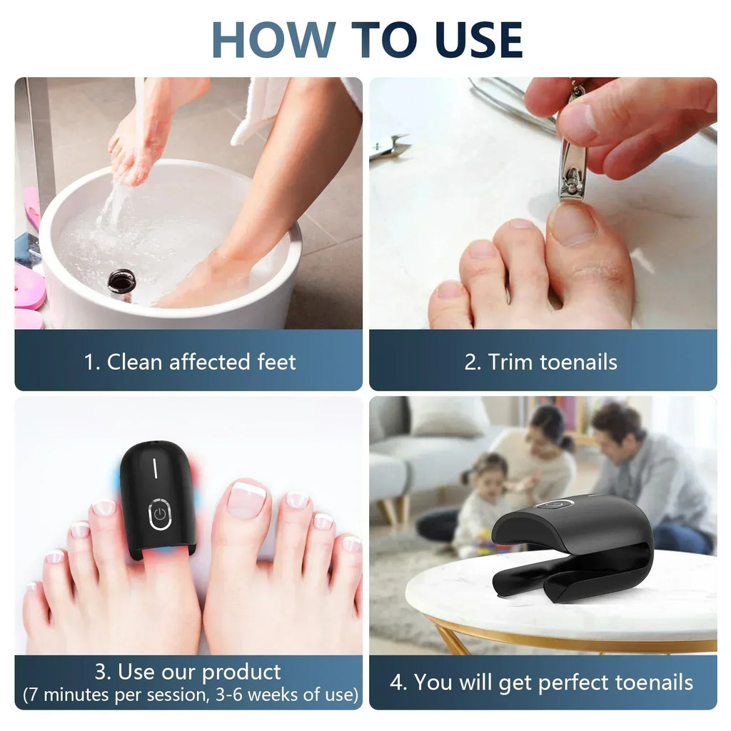Portable Toenail Fungus Laser Therapy Device With USB Charging
