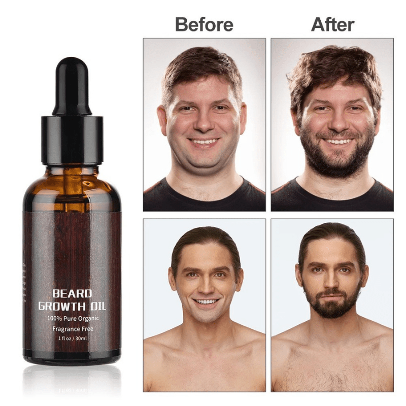 BeardBloom Growth Kit For A Healthy And Strong Beard