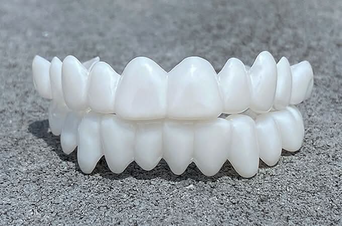 LuminDent Denture With White Dental Lenses For Aesthetic Smile