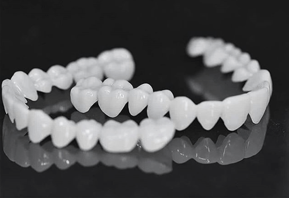 LuminDent Denture With White Dental Lenses For Aesthetic Smile