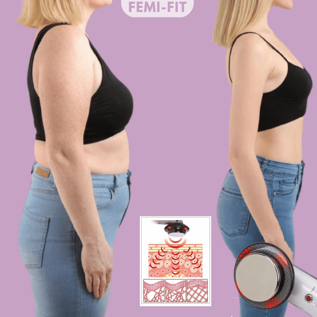 VivaShape Brûleur 3-en-1 De Cellulite Et Graisse Avec EMS Ultrasons Et Infrarouge