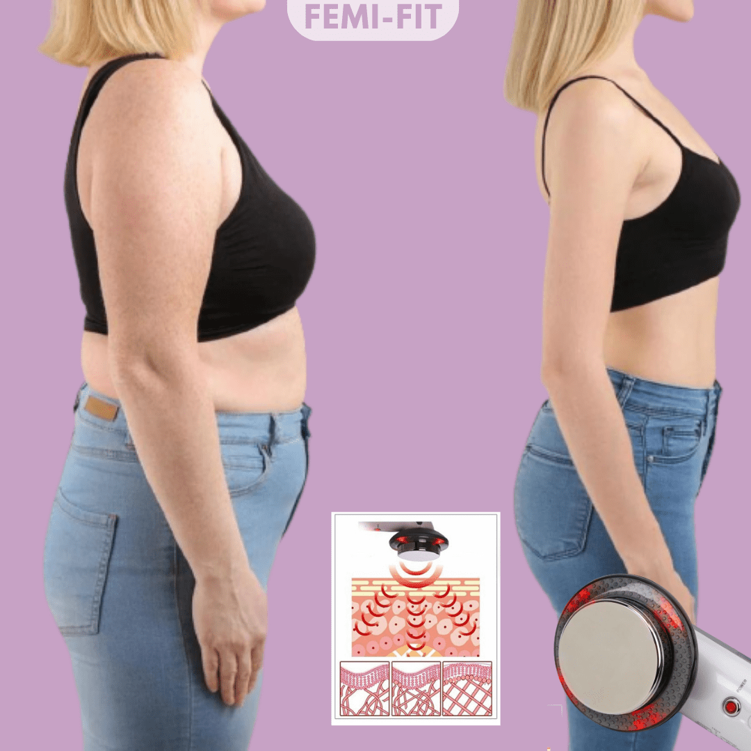 VivaShape Brûleur 3-en-1 De Cellulite Et Graisse Avec EMS Ultrasons Et Infrarouge