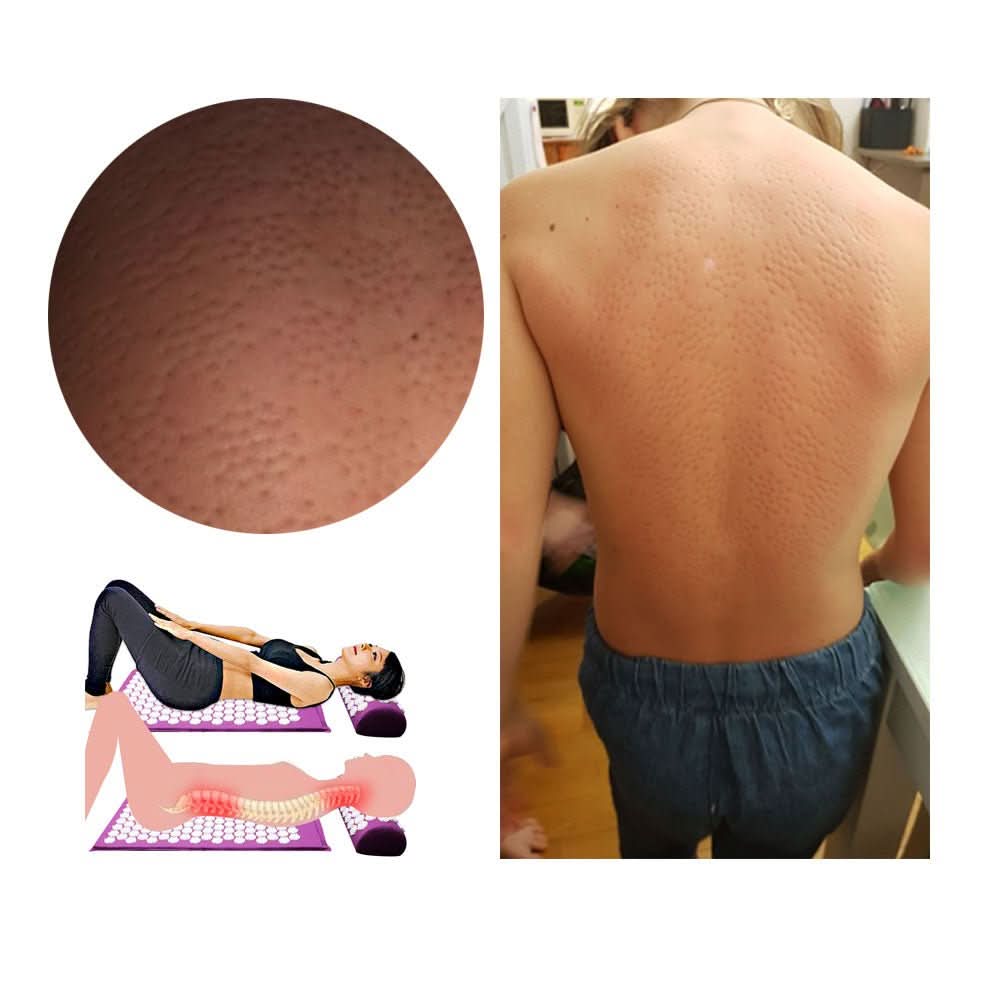 Conjunto de Tapete e Almofada de Acupressão da Relaxpress para Relaxamento Profundo e Alívio da Dor