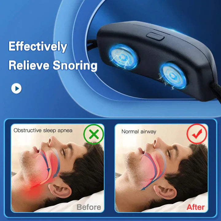 EMS Pulse Anti Snore Device For Portable Comfortable Sleep
