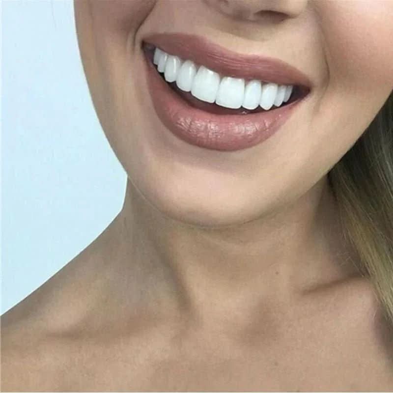SnapFit Smile Enhancer för omedelbart självförtroende utan tandläkarbesök
