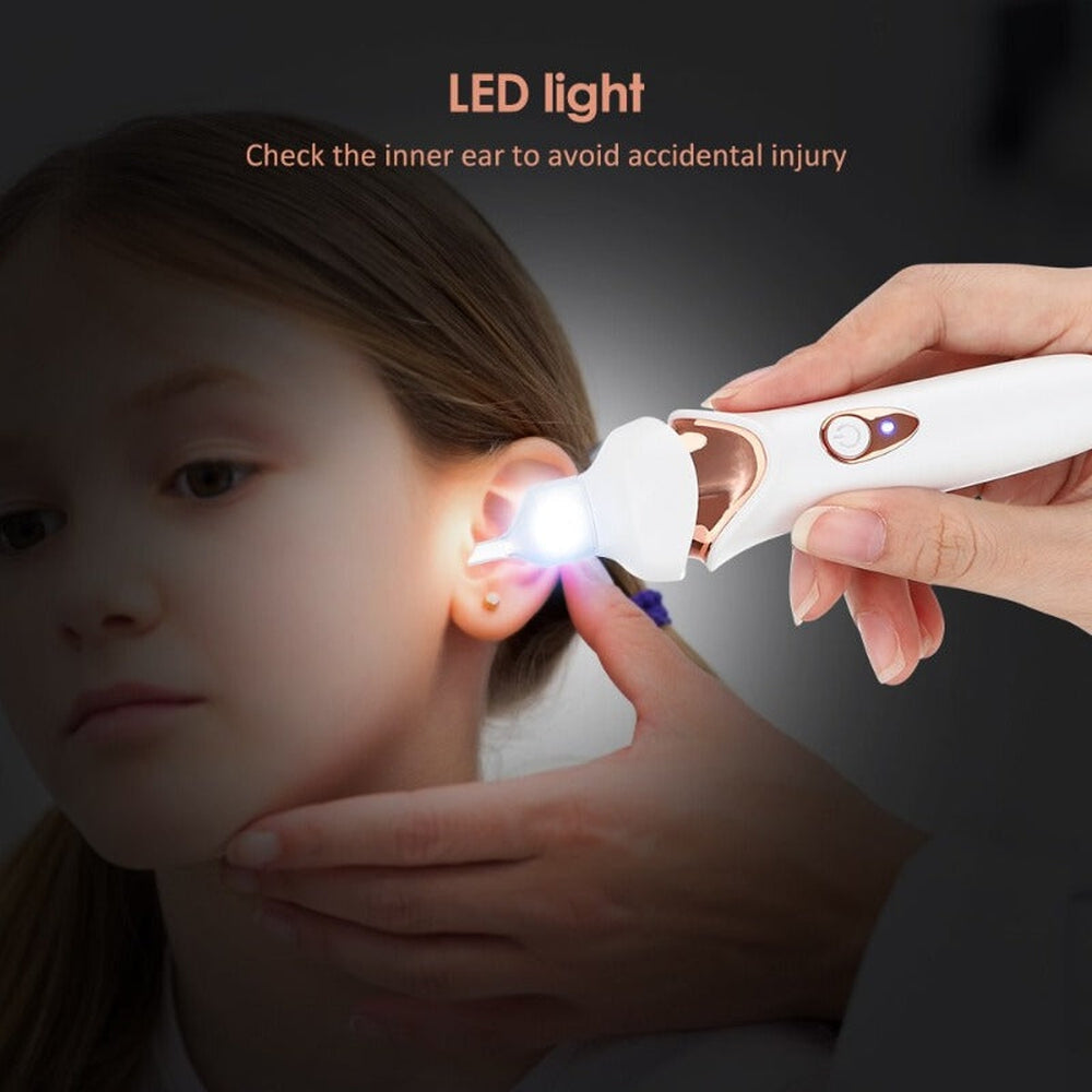 AuralEase Painless Ear Wax Vacuum for Deep Ear Wax Removal | Fervei